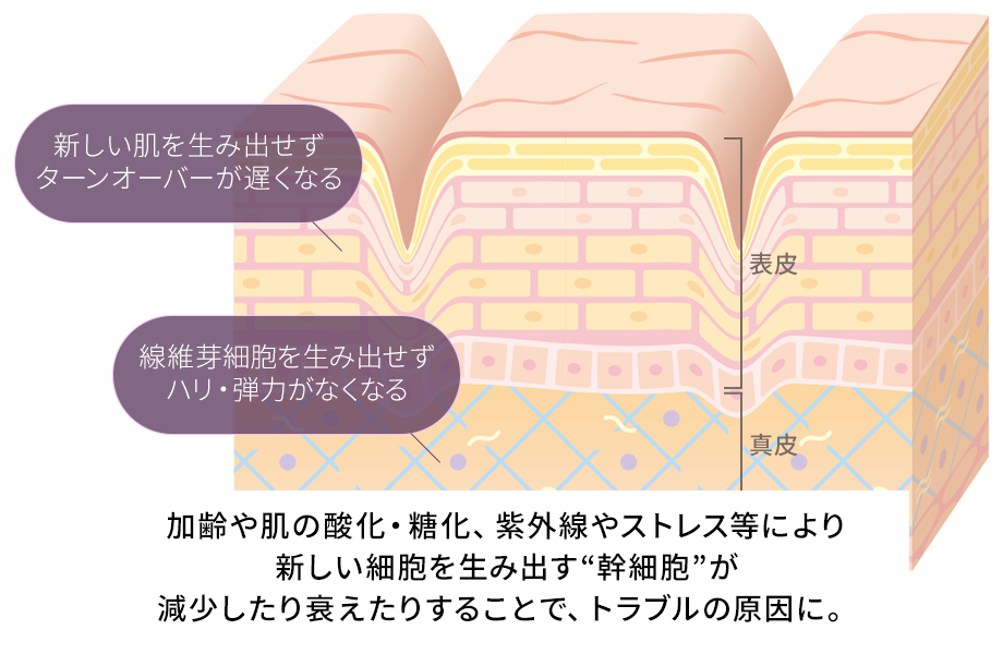 加齢や紫外線などのストレスなどにより【幹細胞】が減少、衰えることでトラブルの原因に